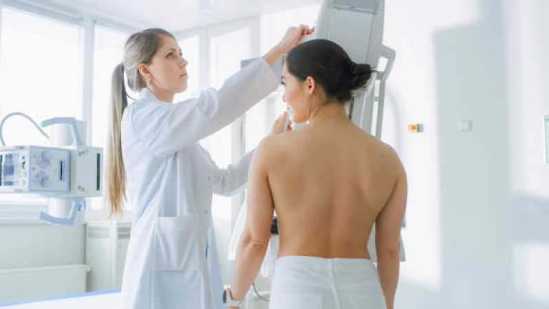 Clínica Especializada em Exame de Mamografia da Mama Jardim Panorama - Exame de Mamografia