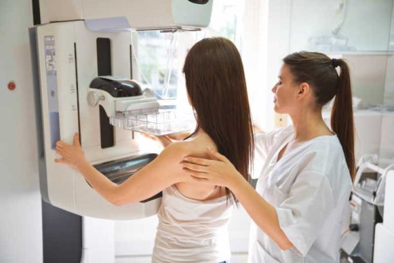 Clínica Especializada em Exame de Mamografia de Rastreamento Jardim Marajoara - Exame de Mamografia de Rastreamento