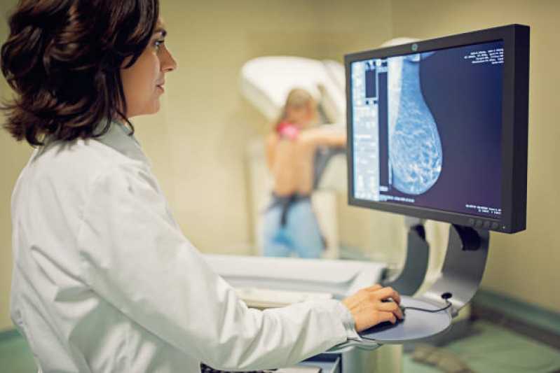Clínica Especializada em Exame de Mamografia Digitalizada Jardim Anhanguera - Exame de Mamografia