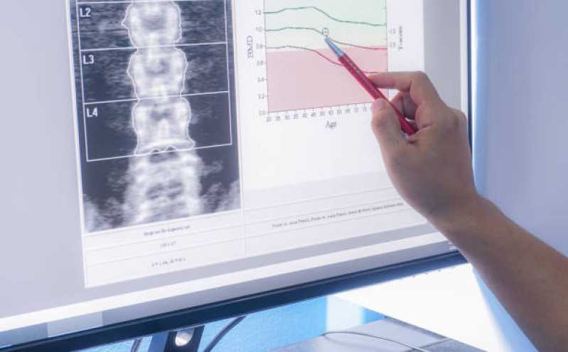 Exame de Densitometria óssea de Antebraço Jardim Bélgica - Exame de Densitometria óssea da Coluna