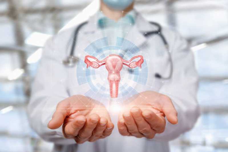 Exame de Histerossalpingografia com Contraste Agendar Portal do Morumbi - Exame de Histerossalpingografia do Colo do útero