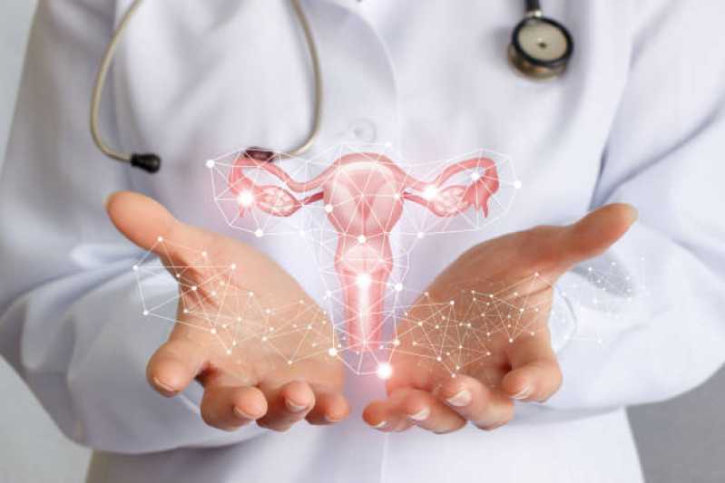 Exame de Histerossalpingografia Ginecológico Socorro - Exame de Histerossalpingografia no útero