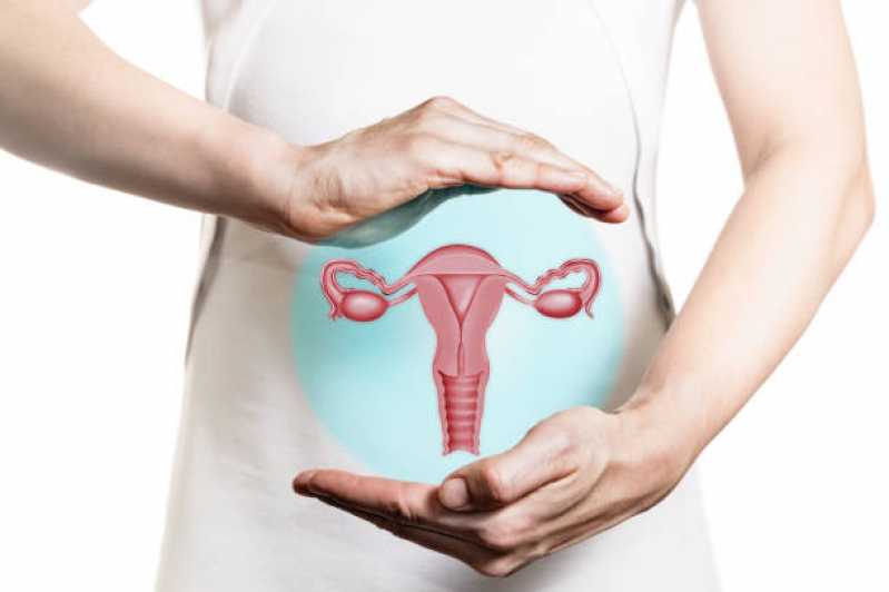 Exame de Histerossalpingografia para Endometriose Agendar Vila Progredior - Exame de Histerossalpingografia no útero