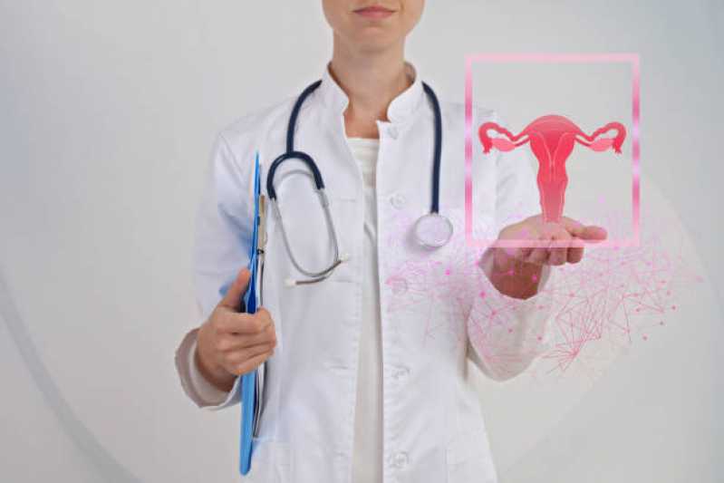 Exame de Histerossalpingografia Vila Olímpia - Exame de Histerossalpingografia para Endometriose