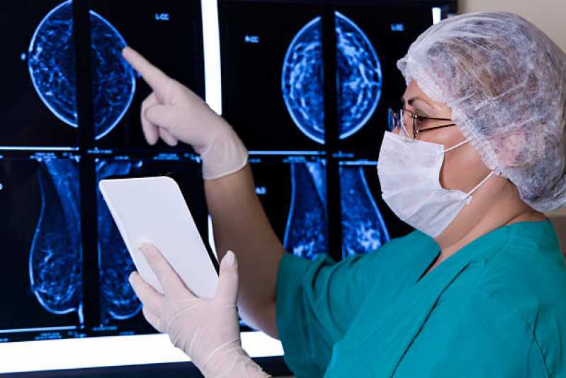 Exame de Mamografia Bilateral Digital Marcar Morumbi - Exame de Mamografia