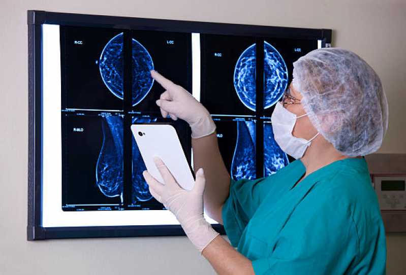 Exame de Mamografia Bilateral Digital Jardim Bélgica - Exame de Mamografia de Rastreamento