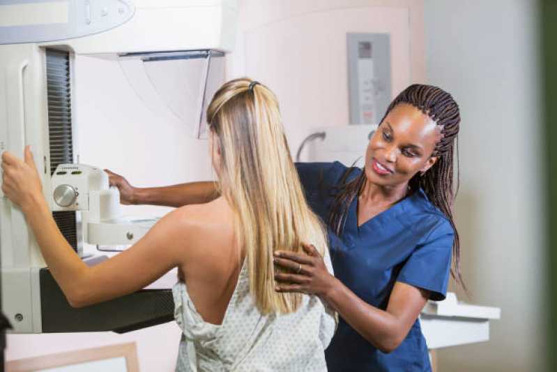 Exame de Mamografia Bilateral Marcar Vila Ida - Exame de Mamografia da Mama