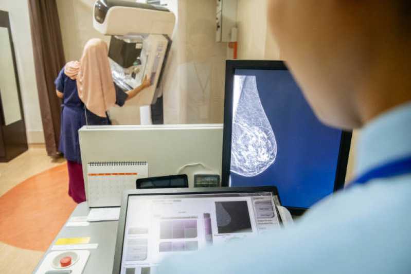 Exame de Mamografia da Mama Marcar Vila Fazzeoni - Exame de Mamografia Masculina