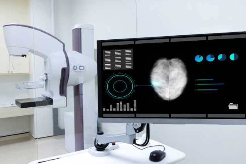 Exame de Mamografia de Rastreamento Jardim Santo Amaro - Exame de Mamografia Masculina
