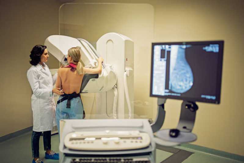Exame de Mamografia Digital Bilateral Parque Novo Santo Amaro - Exame de Mamografia Bilateral