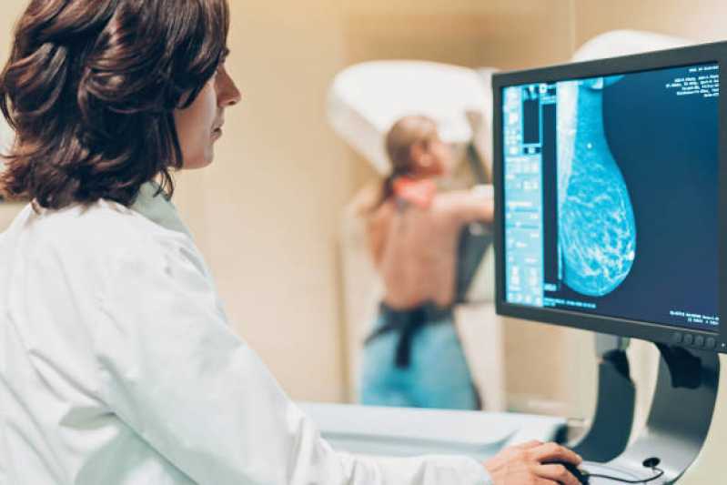 Exame de Mamografia Digitalizada Marcar Chácara ST Antônio - Exame de Mamografia de Rastreamento