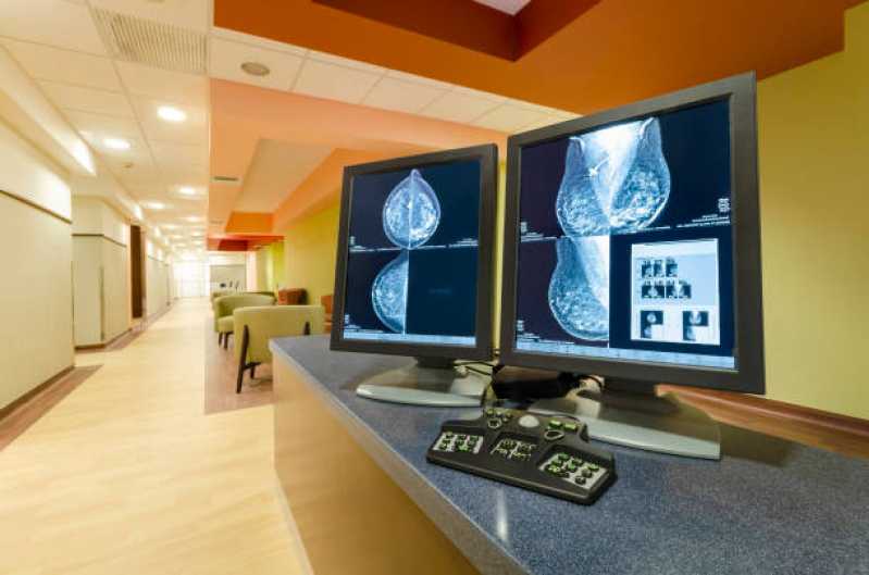 Exame de Mamografia Digitalizada Vila Cruzeiro - Exame de Mamografia Digital Bilateral