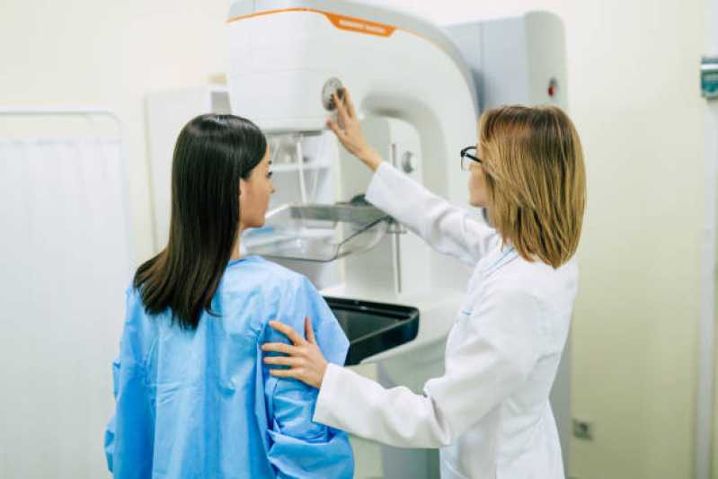 Exame de Mamografia Mamária Marcar Giovanni - Exame de Mamografia Masculina