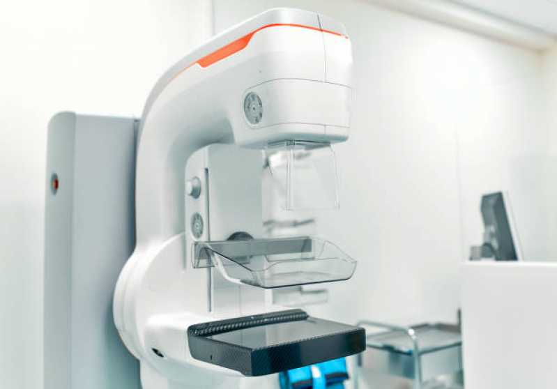 Exame de Mamografia Mamária Vila Tramontano - Exame de Mamografia Digital Bilateral