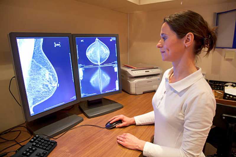 Exame de Mamografia Masculina Marcar Indianópolis - Exame de Mamografia Mamária