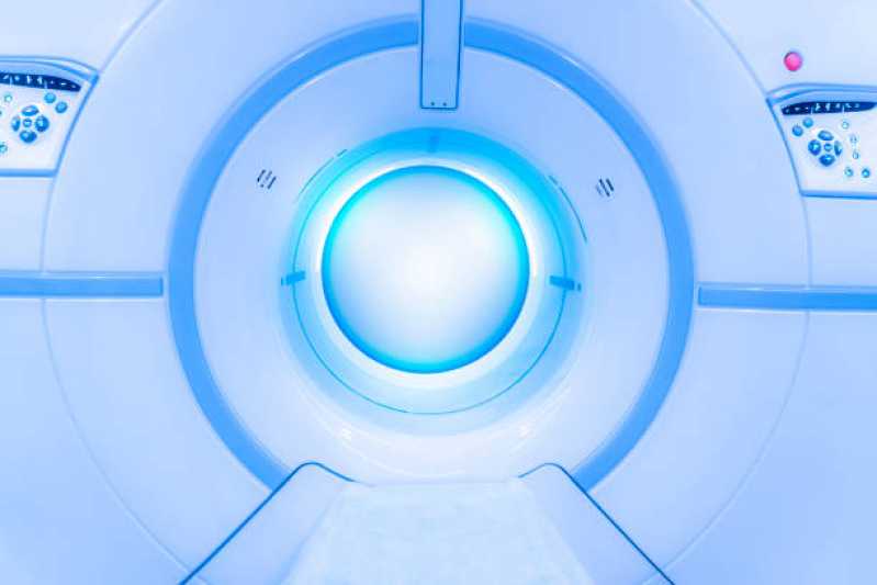 Exame de Ressonância Magnética Cerebral Marcar Granja Julieta - Exame de Ressonância Magnética de Abdomen