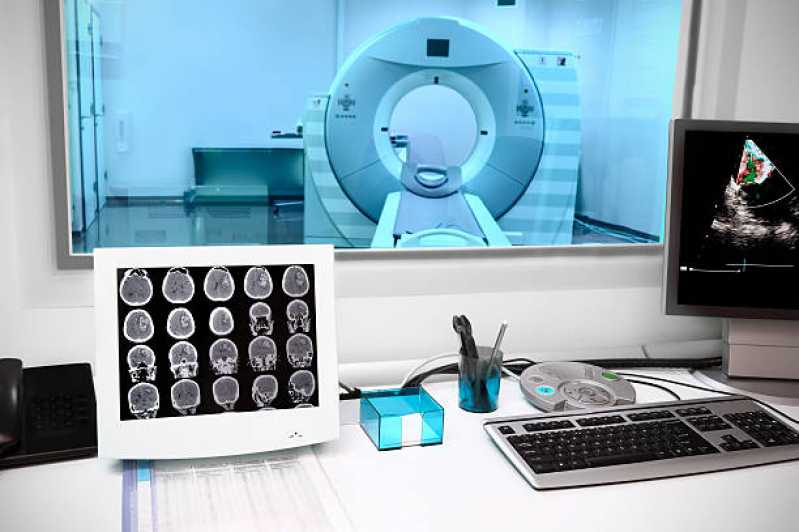 Exame de Tomografia Computadorizada da Coluna Marcar Grajaú - Exame de Tomografia Computadorizada do Crânio