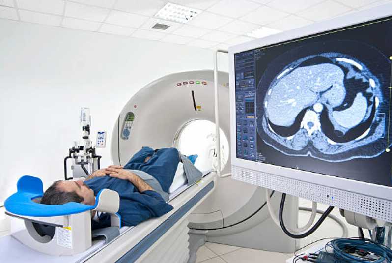 Exame de Tomografia Computadorizada de Tórax João Dias - Exame de Tomografia Computadorizada da Lombar