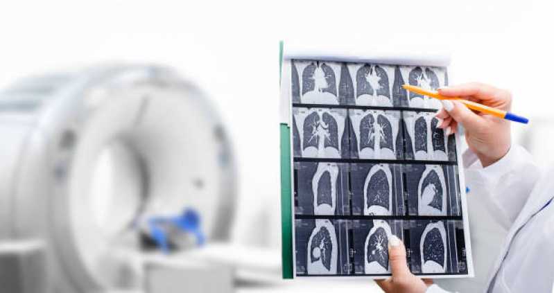 Exame de Tomografia Computadorizada do Punho Parelheiros - Exame de Tomografia Computadorizada do Crânio