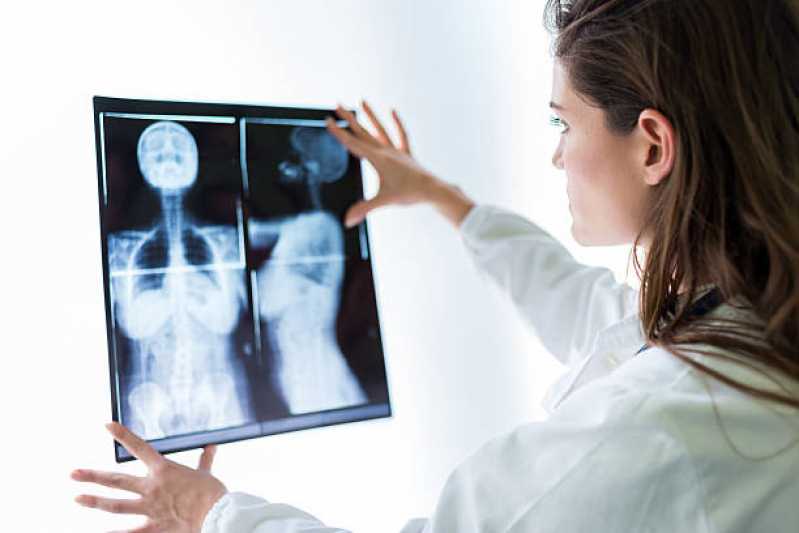 Onde Fazer Exame de Mamografia Bilateral Digital Chácara Pouso Alegre - Exame de Mamografia Bilateral Digital
