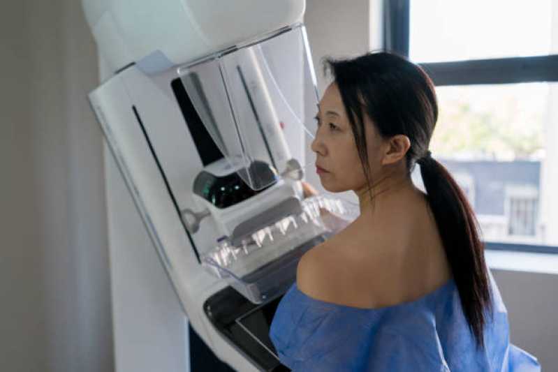 Onde Fazer Exame de Mamografia Bilateral Jabaquara - Exame de Mamografia Grande São Paulo
