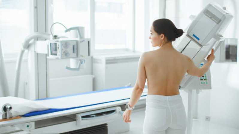 Onde Fazer Exame de Mamografia da Mama Indianópolis - Exame de Mamografia Mamária