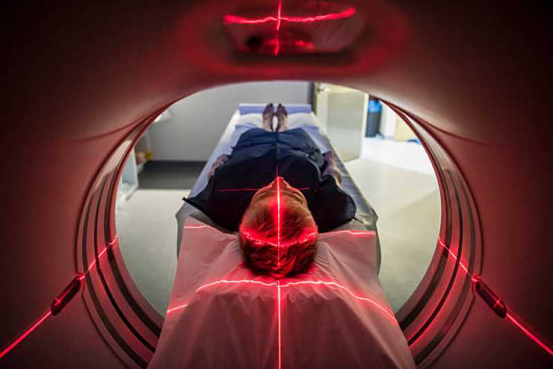 Preço de Exame de Ressonância Magnética da Pelve Socorro - Ressonância Magnética de Crânio