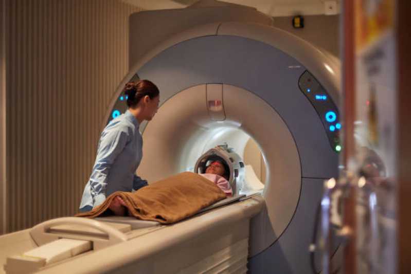 Preço de Exame de Ressonância Magnética do Ombro Vila Ida - Exame de Ressonância Magnética Cerebral