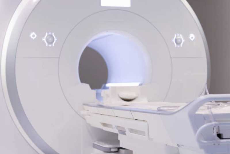 Ressonância Magnética de Coluna Dorsal Indianópolis - Exame de Ressonância Magnética Cerebral