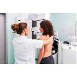 clínica especializada em exame de mamografia bilateral digital Vila Sofia