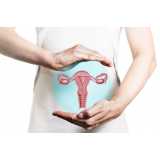 exame de histerossalpingografia para endometriose agendar Vila Anhanguera