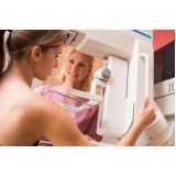 exame de imagem mamografia Campo Limpo