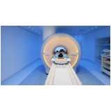 exame de imagem ressonância magnética agendar Vila Mascote