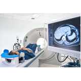 exame de imagem tomografia computadorizada agendar Vila Califórnia