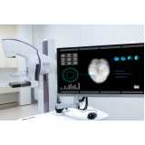 exame de mamografia de rastreamento Jardim Anhanguera