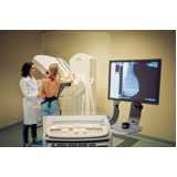 exame de mamografia digital bilateral Moema Pássaros