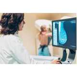 exame de mamografia digitalizada marcar Vila Liviero