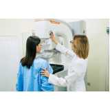 exame de mamografia mamária marcar Cursino
