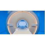 exame de ressonância magnética cerebral Indianópolis