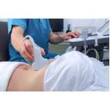 exame de ultrassonografia da mama Cidade Ademar