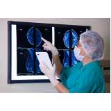 Exame de Mamografia Computadorizada