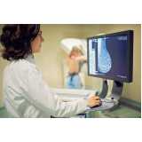 Exame de Mamografia Digitalizada