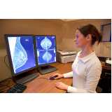 Exame de Mamografia Masculina