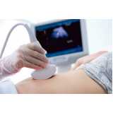 Exame Ultrassonografia Transvaginal
