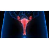 onde fazer exame de histerossalpingografia para endometriose Moema Índios