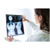 onde fazer exame de mamografia bilateral digital Vila Olímpia