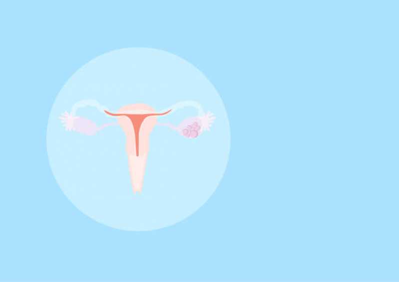 Valor de Exame de Histerossalpingografia com Contraste Vila Progredior - Exame de Histerossalpingografia para Endometriose