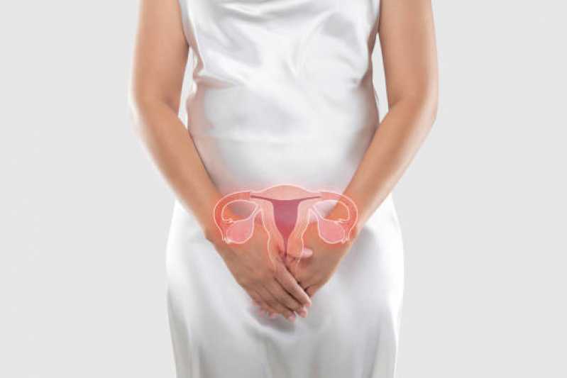 Valor de Exame de Histerossalpingografia com Sedação Total Vila Suzana - Exame de Histerossalpingografia no útero