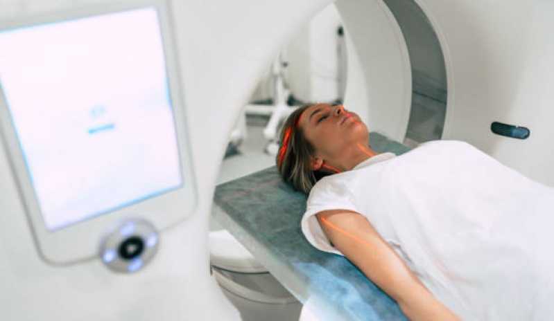 Valor de Exame de Tomografia Computadorizada do Braço Socorro - Exame de Tomografia Computadorizada de Abdômen