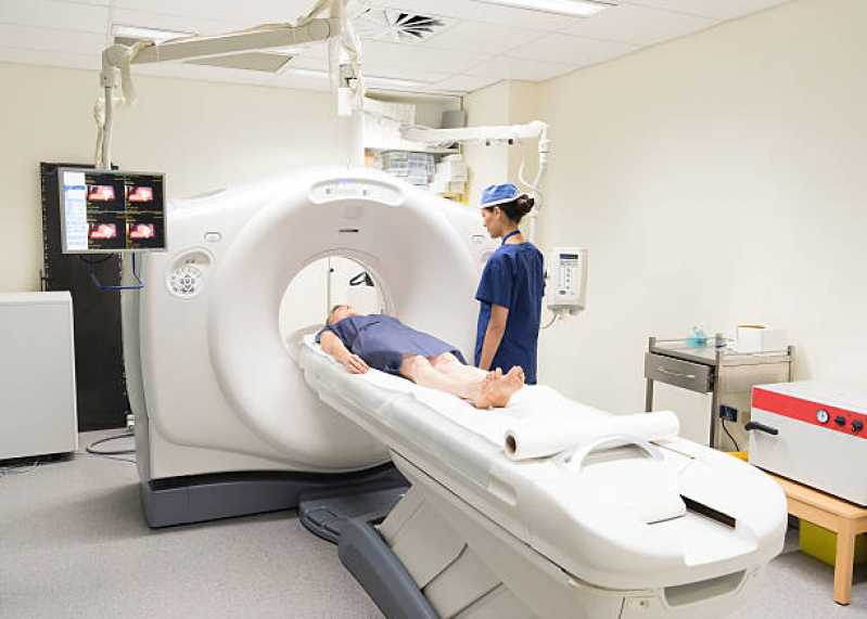 Valor de Exame de Tomografia Computadorizada do Ombro Socorro - Exame de Tomografia Computadorizada do Crânio